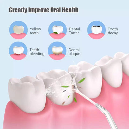 Waterproof Irrigator Dental Cleaner - TravelBall